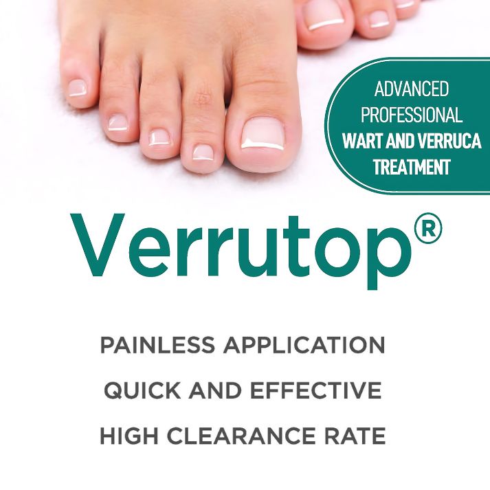 What is Verrutop? Understanding Its Benefits and Application for Foot Health Professionals