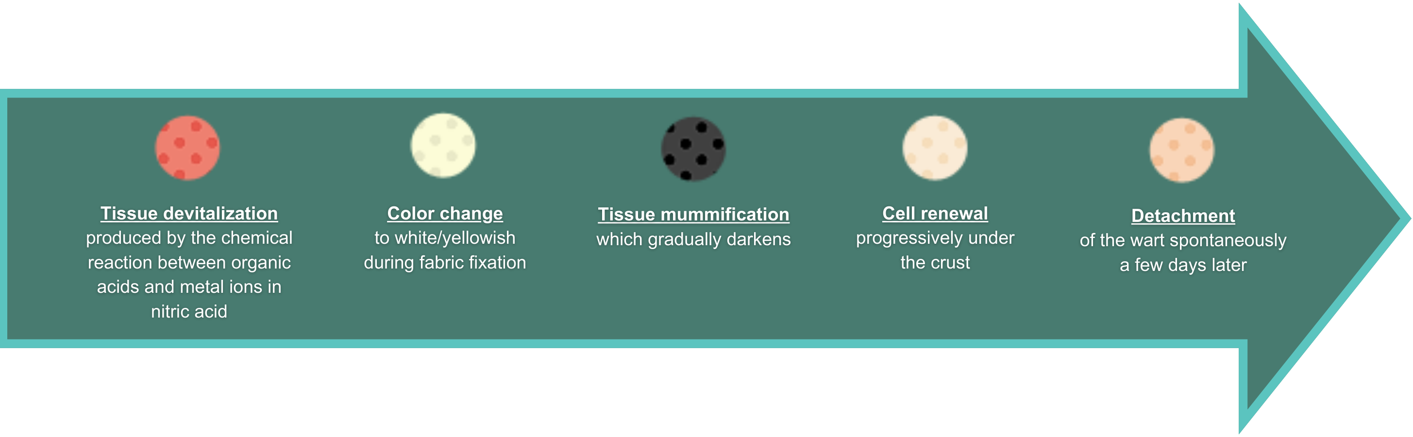 Verrutop painless mummification process